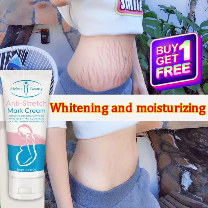 *BUY 1 FREE 1* ANTI STRETCH MARK CREAM (60G) SG SELLER & FAST DELIVERY *FADE STRETCH MARK LINES* MOISTURISING & BRIGHTENING *ENHANCE SKIN ELASTICITY*